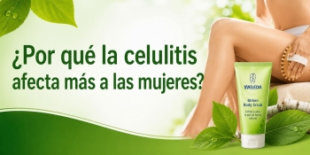 &iquest;Por qu&eacute; la celulitis afecta m&aacute;s a las mujeres?